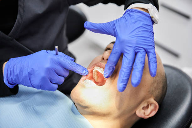 Best Emergency Dental Care for Broken or Chipped Teeth in Kings Point, NY